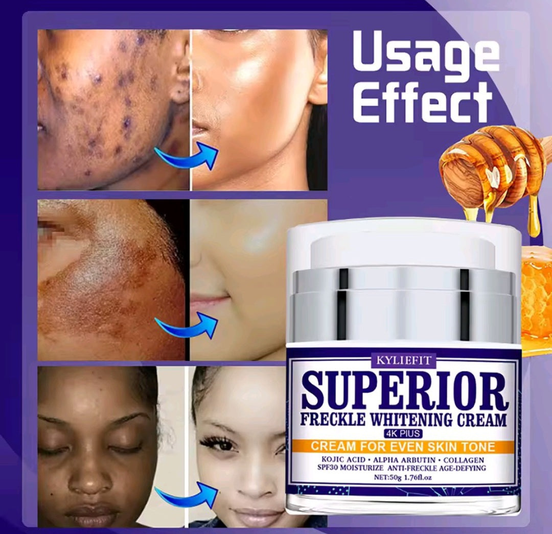 KYLIEFIT Dark Spot Remover for Face, Hyperpigmentation, Melasma, Freckle, Sun Spots Removal, Whitening Cream for Women and Men